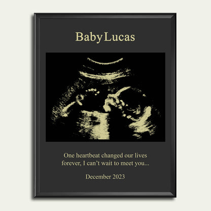 Baby Ultrasound Art